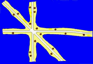 A Multinucleated sponge cell.