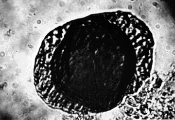 Fossil Pollen Grains